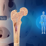 5-reasons-your-bone-growth-may-be-slowed